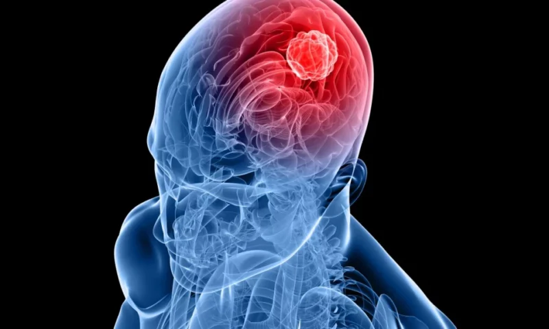 dr.consulta-cancer-no-cerebro-2-1024x576